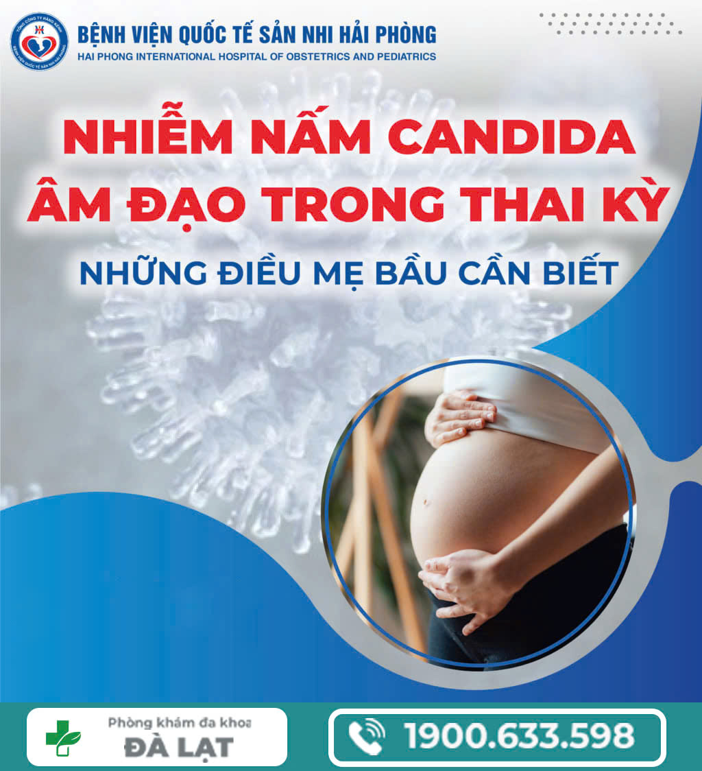 Hình ảnh minh họa